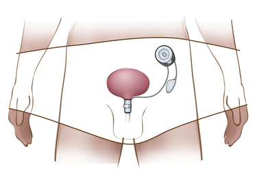 UriControl Placement